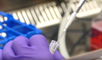 GGD regio Utrecht begint met vaccinatie tegen apenpokken